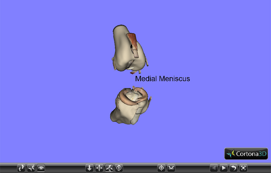 3D interactive VRML illustration of a human knee